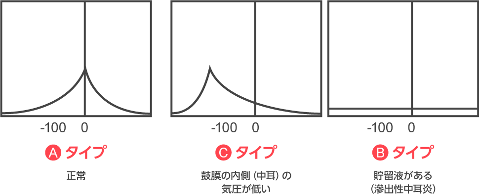 チン パノ メトリー と は